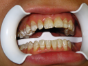 Примерная программа дисциплины стоматология модуль «клиническая стоматология» preview 1
