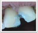 Примерная программа дисциплины стоматология модуль «клиническая стоматология» preview 4